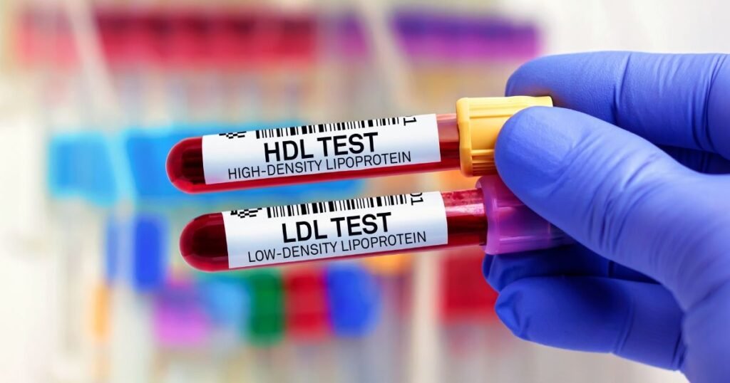 Lipoproteína a: Riscos, Exame e Como Reduzir