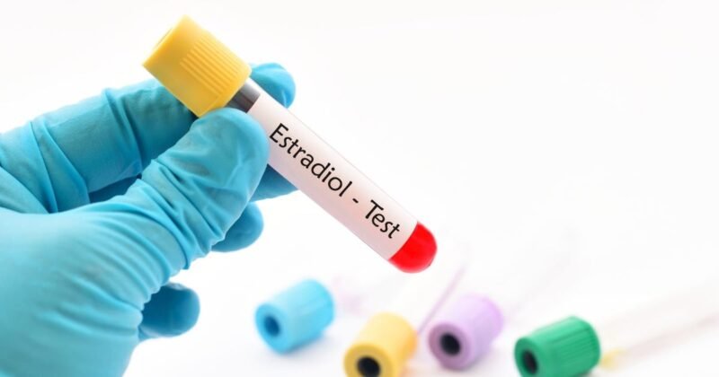 exame de estradiol