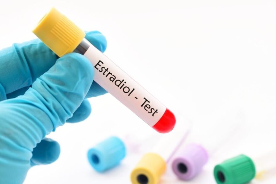 exame de estradiol