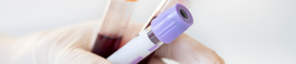 coleta de sangue para check-up ist