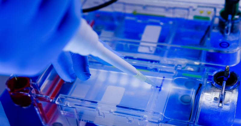 técnica para o exame de eletroforese de hemoglobina