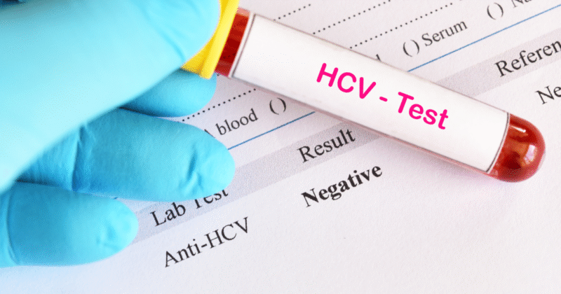 hepatite c transmissão: importância dos exames no diagnóstico precoce.
