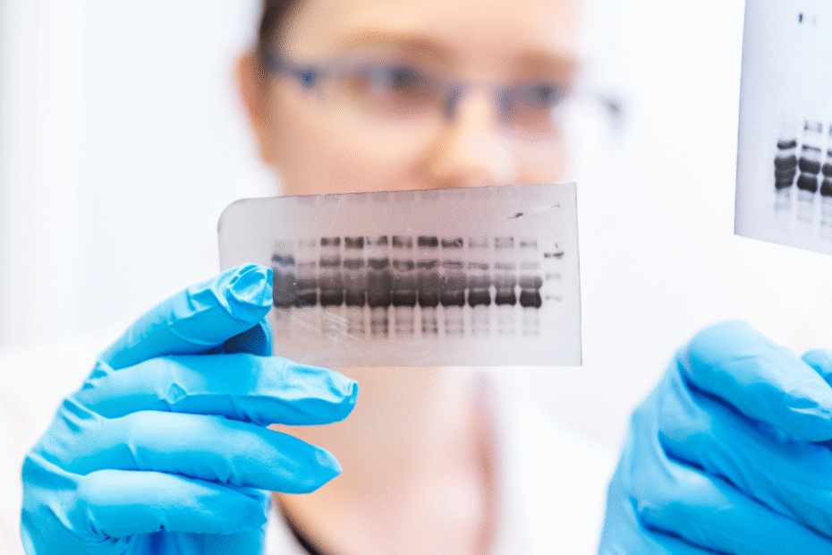 técnica analisando corrida de eletroforese de proteínas