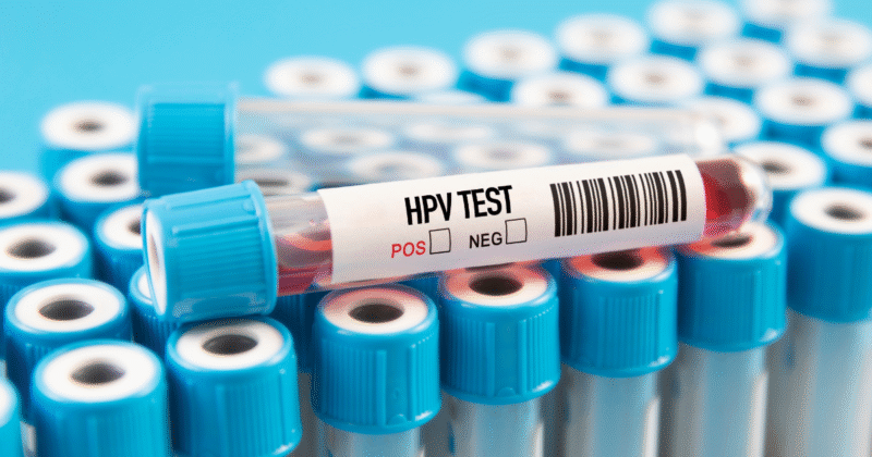 tubos para realização de exame de sangue para hpv