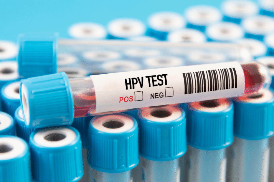 tubos para realização de exame de sangue para hpv