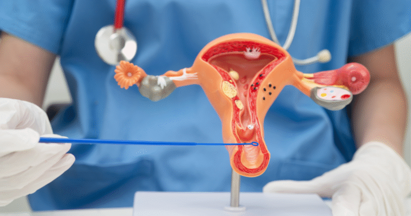 Médico demonstrando o aparelho reprodutor feminino ao falar sobre infecções como tricomoníase e corrimento verde.