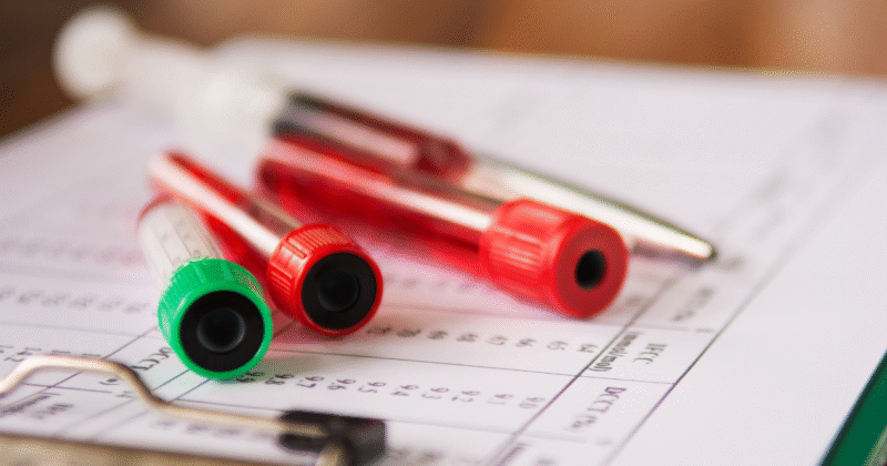 Tubos de ensaio posicionados sobre um pedido médico, representando a coleta do exame G6PD.