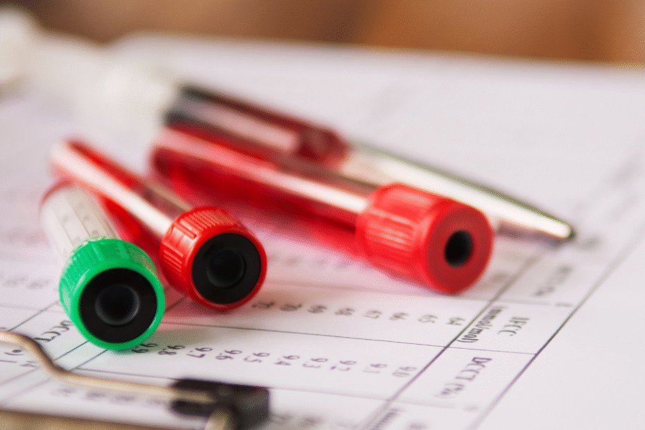 Tubos de ensaio posicionados sobre um pedido médico, representando a coleta do exame G6PD.