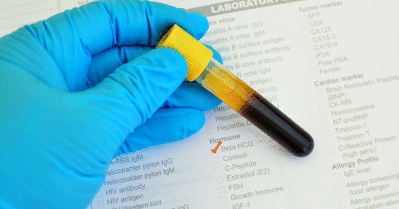 Como saber o tempo de gravidez pelo Beta hCG quantitativo Tubo de sangue sobre pedido médico ilustrando como saber o tempo de gravidez pelo Beta hCG quantitativo.