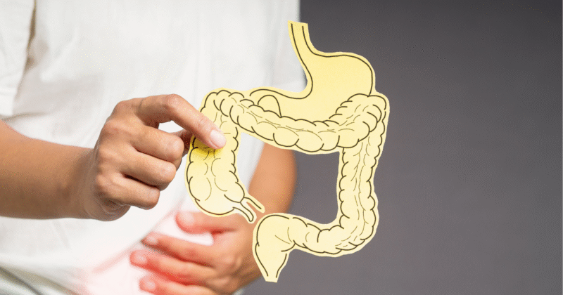 indican exame - avaliação da disbiose intestinal.