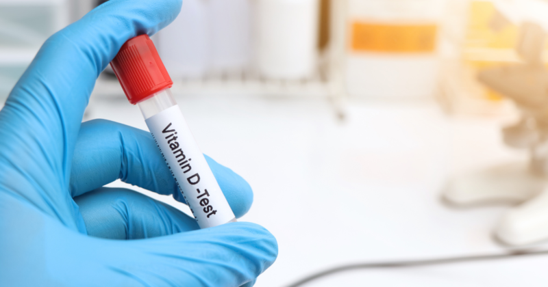 exame de vitamina d realizado por coleta de sangue
