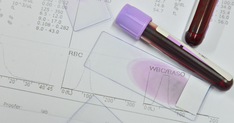 Resultado de hemograma mostrando leucócitos baixos no exame de sangue
