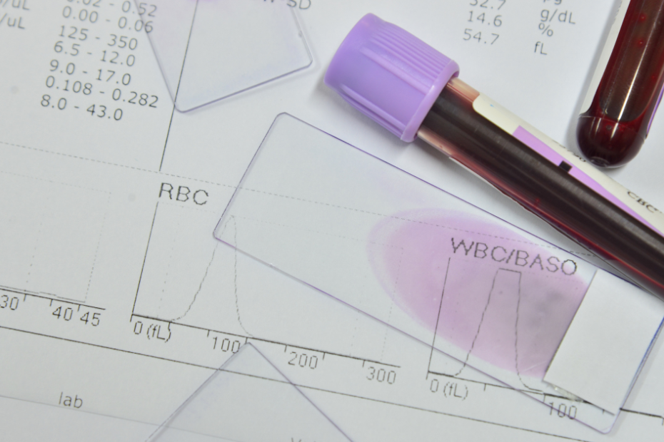 Resultado de hemograma mostrando leucócitos baixos no exame de sangue