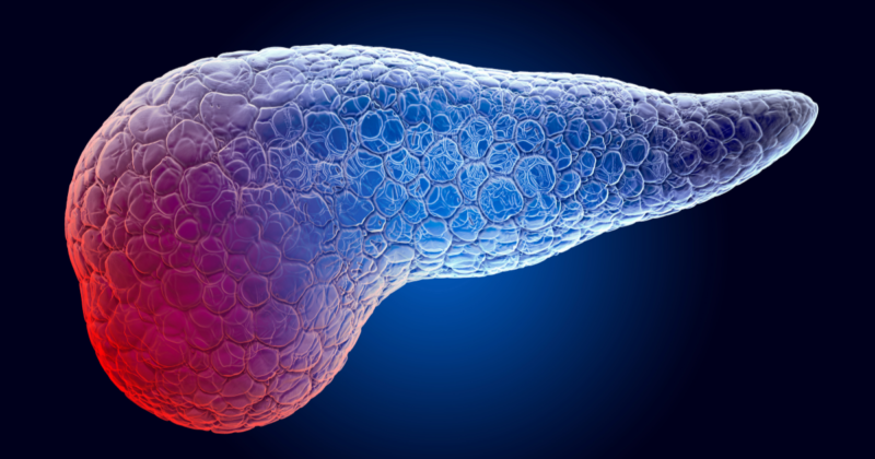 Amilase e Lipase: Quando Investigar, Valores Normais e o Que Pode Estar Alterado Ilustração do pâncreas com área destacada representando inflamação associada à alteração de amilase e lipase