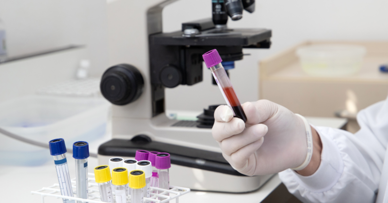 DHT alto: sintomas, causas e quando investigar com exame de sangue exame de sangue para dosagem de DHT alto em laboratório