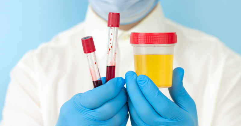 Profissional segurando frasco de urina e tubos de sangue para exame de proteinúria