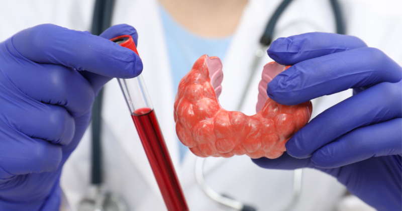 Exame T4 Livre: Para Que Serve, Valores Normais e Quando Investigar Exame T4 livre para avaliação da tireoide com coleta de sangue em laboratório