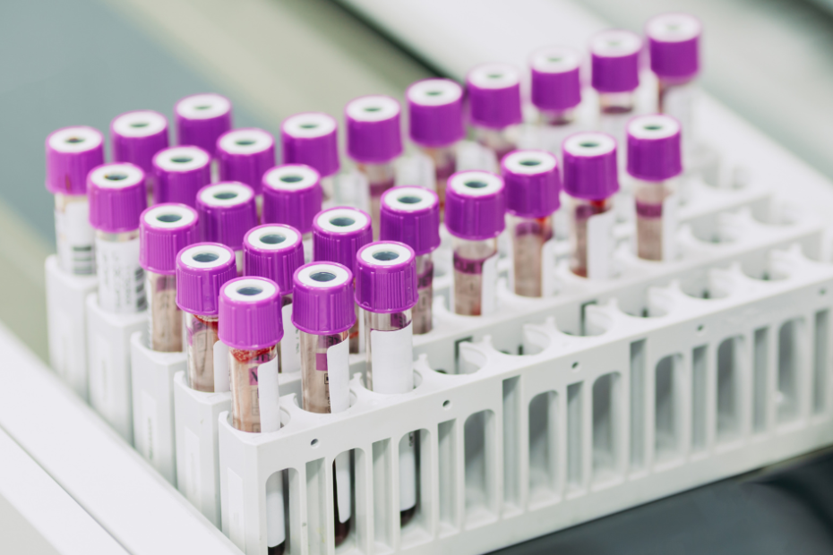 Marcadores tumorais femininos em exame de sangue com tubos de amostras laboratoriais