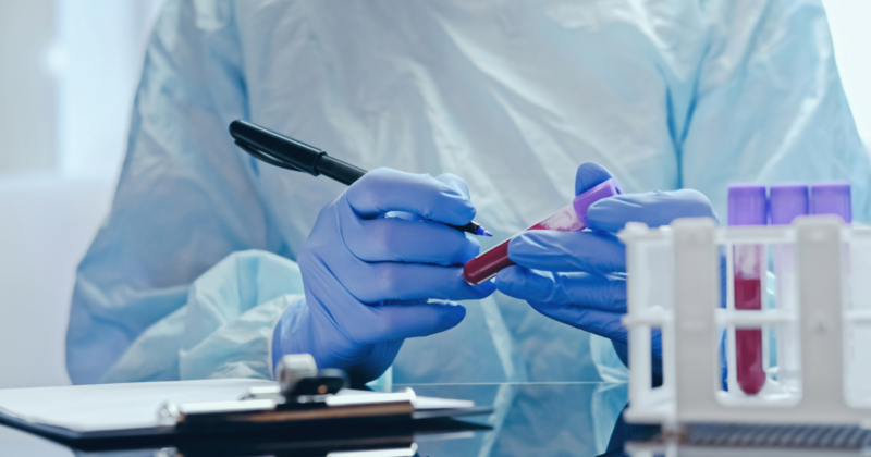 Prolactina Alta em Homens: Sintomas, Causas e Relação com Hormônios exame de sangue para prolactina alta em homens realizado em laboratório