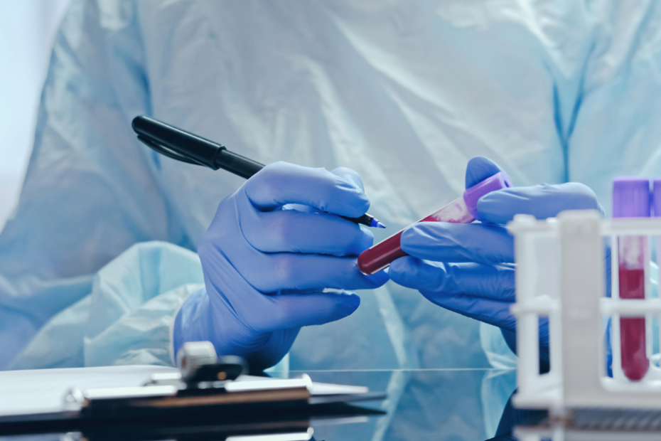 exame de sangue para prolactina alta em homens realizado em laboratório