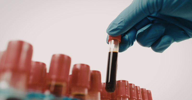 Transferrina: o que é, para que serve e como interpretar o exame Exame de transferrina realizado por coleta de sangue em laboratório clínico