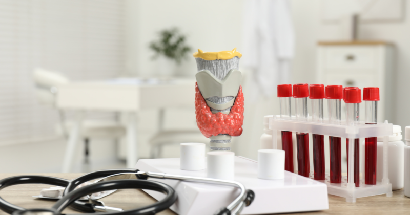 TSH alterado exame de sangue com modelo anatômico da tireoide