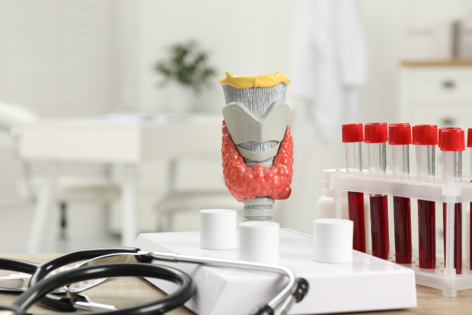 TSH alterado exame de sangue com modelo anatômico da tireoide