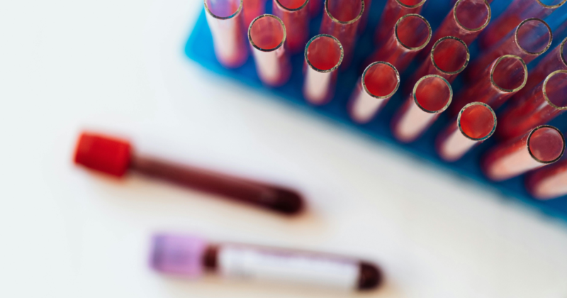 Exame de sangue para IST: quais doenças detecta e quando fazer imagem de tubos para exame de sangue para ist