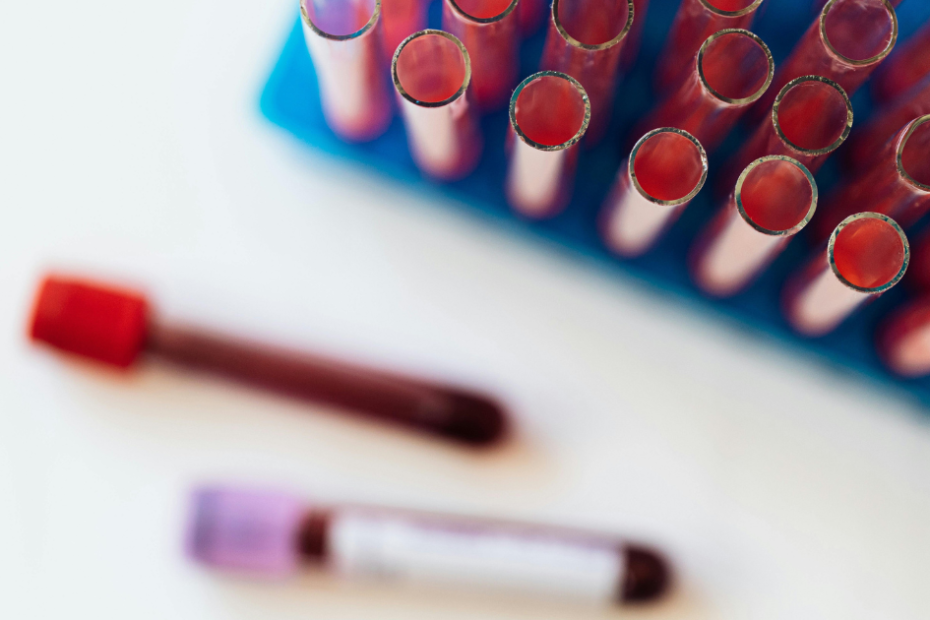 imagem de tubos para exame de sangue para ist