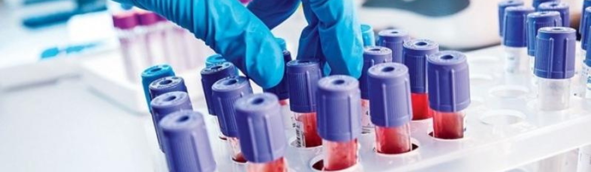 quanto custa exame de sangue em SP com opção de coleta domiciliar no conforto de casa