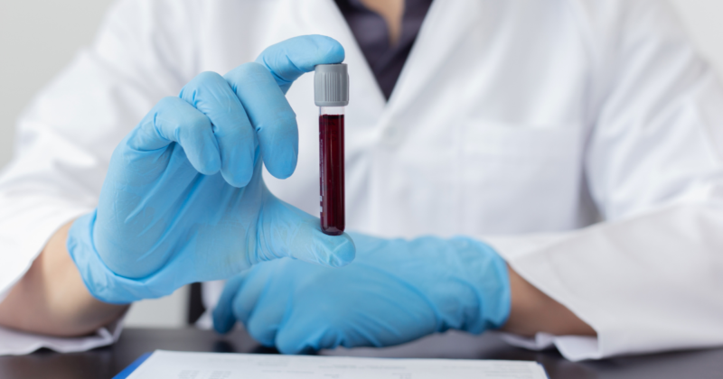 fibrinogênio alto é perigoso? exame de sangue sendo analisado em laboratório