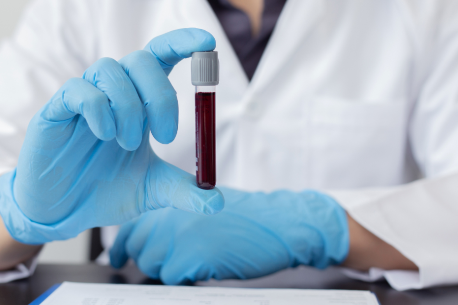 fibrinogênio alto é perigoso? exame de sangue sendo analisado em laboratório