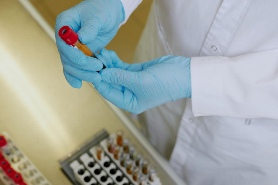 exame de sangue para proteína c reativa alta